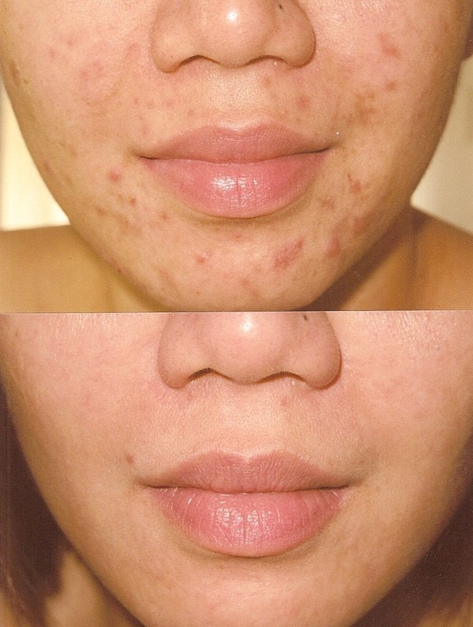 What Sets a Medical Facial Apart