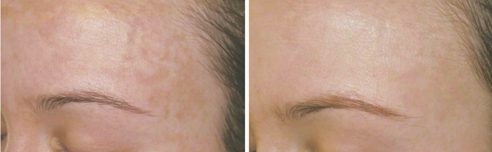 Advanced Clinical Skincare