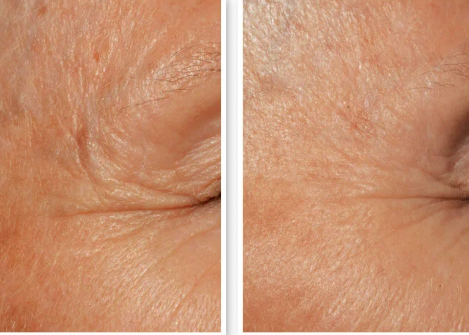 DefenAge® PRO The Science Behind Defensin Molecules