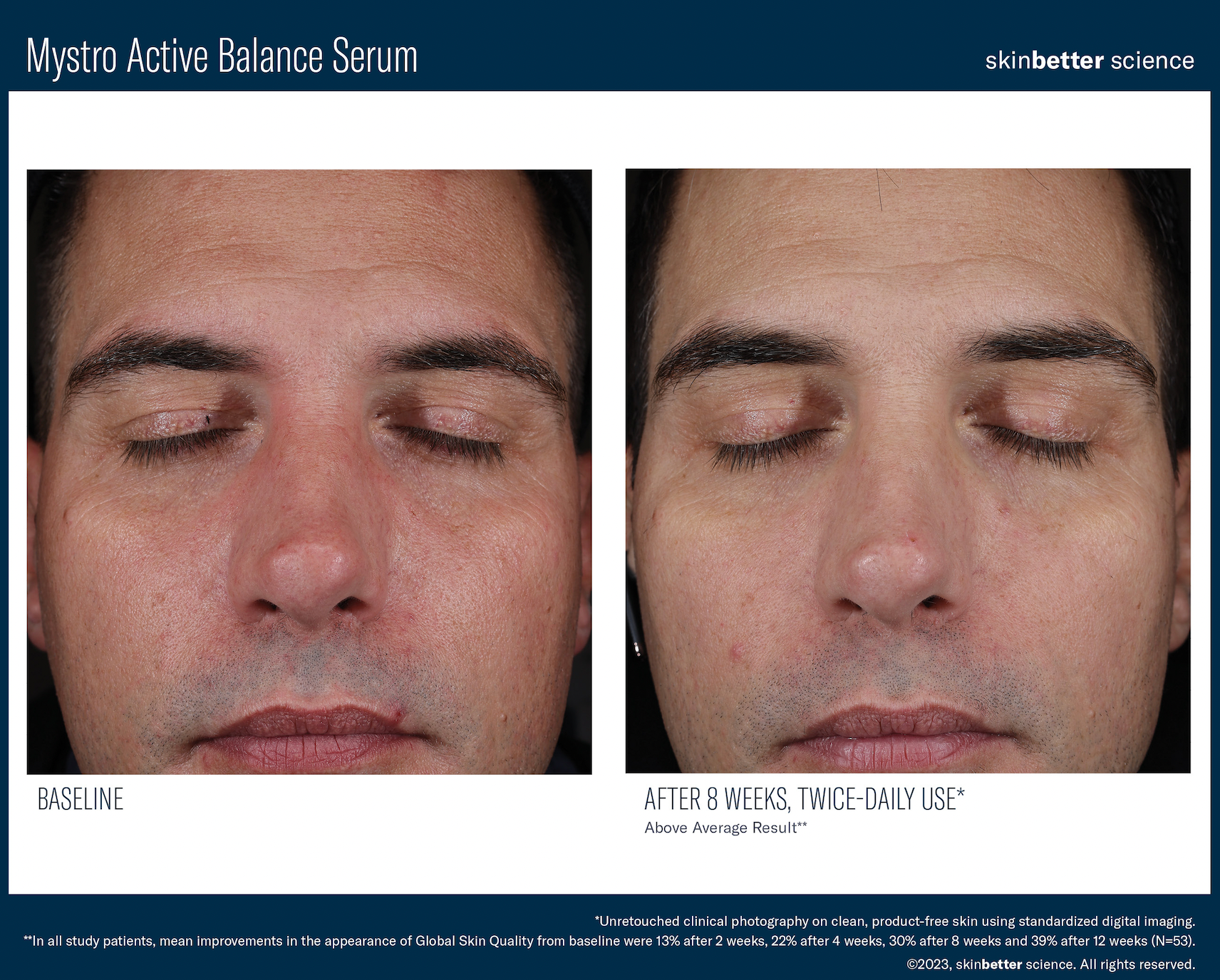 Mystro Active Balance Serum