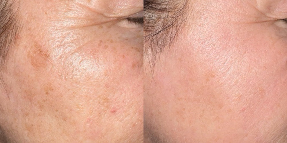 Skinbetter Science Medical-Grade Skincare in San Francisco: Exclusive Partner